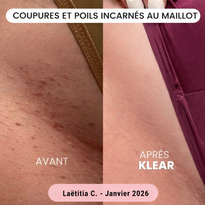 La solution douce pour toutes les zones sensibles