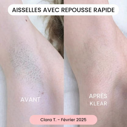 La solution douce pour toutes les zones sensibles